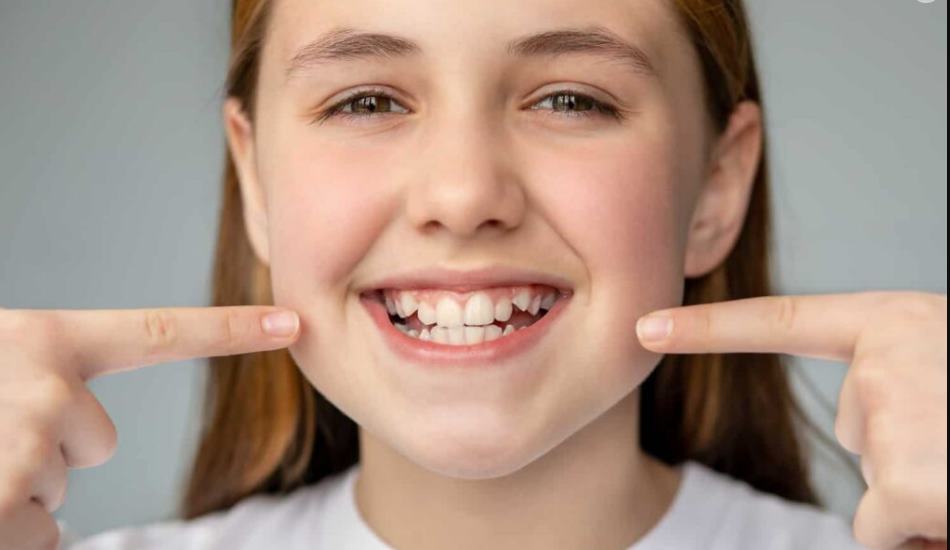 علاج الاسنان المعوجة بدون تقويم
