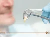 تعليمات بعد خلع الضرس