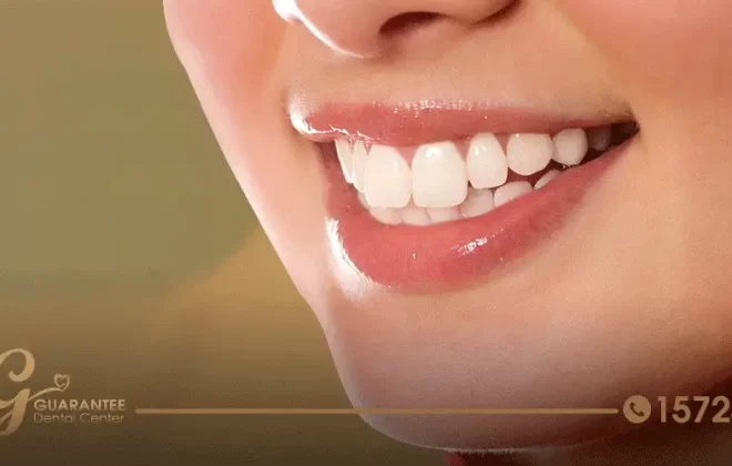 سعر تنظيف الاسنان من الجير في مصر