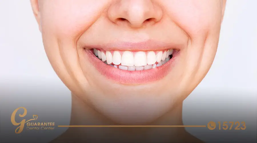 Comprehensive-Smile-Assessment-at-Guarantee-Hollywood-Smile-Center