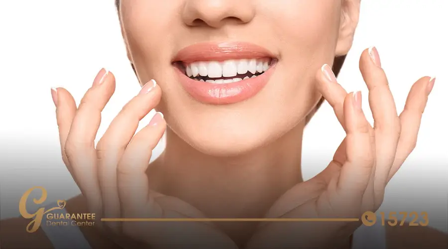Factors-Affecting-Hollywood-Smile-Cost-in-Egypt