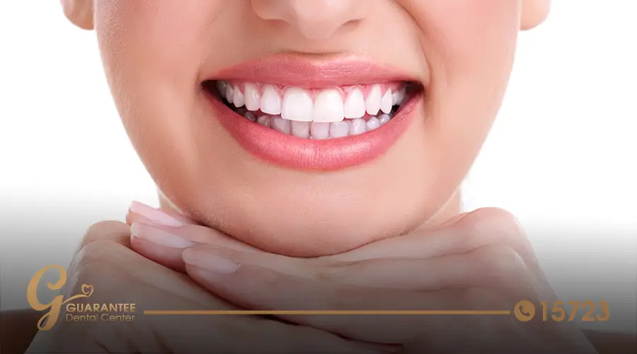 hollywood-smile-cost-near-me