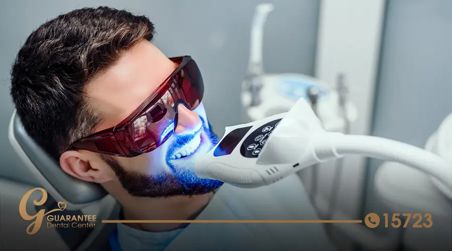 laser-teeth-whitening-cost-in-egypt
