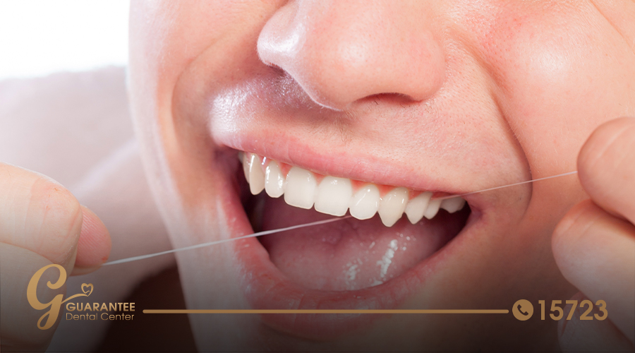 Effective Ways for How to Clean Stains Between Teeth Guarantee