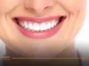 Hollywood Smile