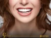 Hollywood Smile vs Natural Smile: An Overview