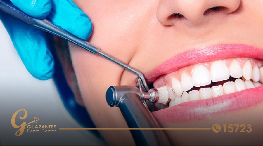 How Much Does a Deep Teeth Cleaning Cost Guarantee Dental