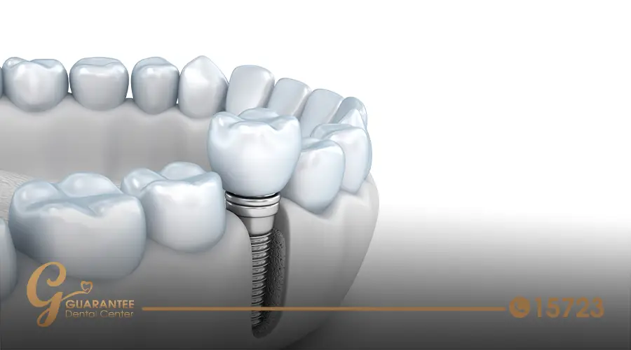 Jaw bone graft