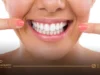 أنواع تجميل الأسنان: الدليل الشامل لاختيار الإجراء المناسب لابتسامة أجمل وأكثر ثقة