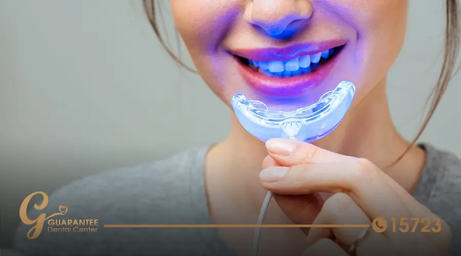 Teeth whitening