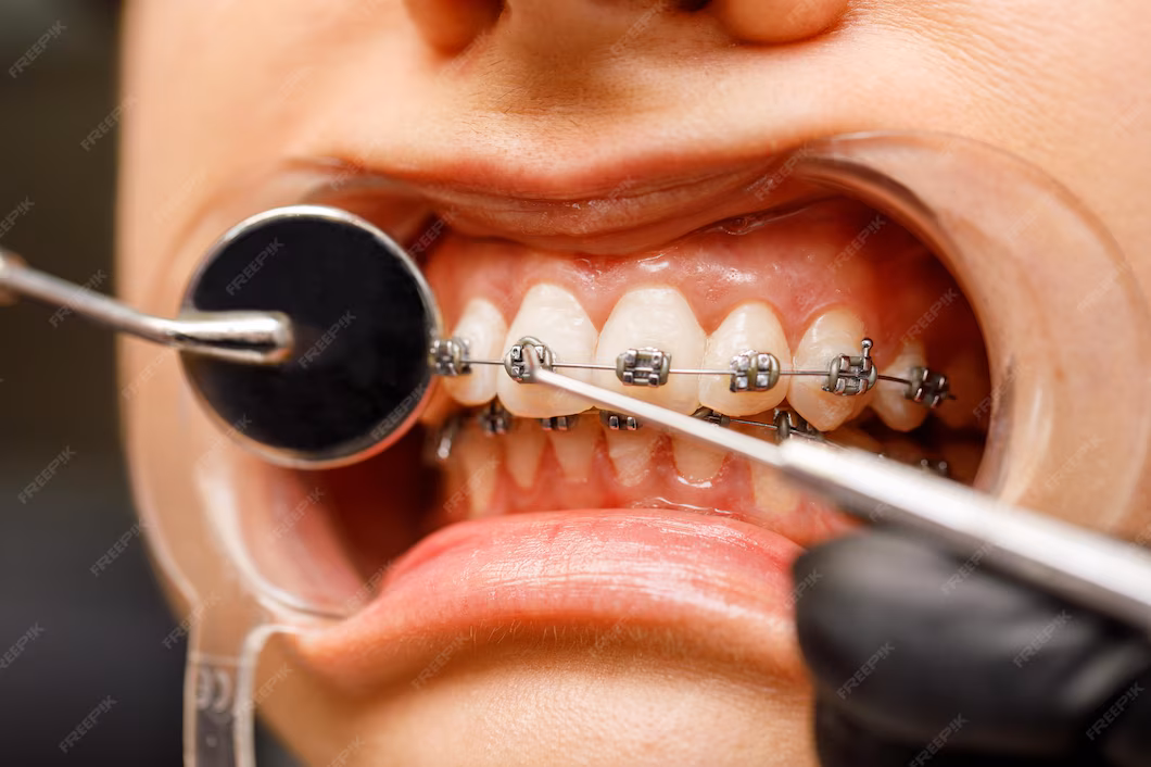 لماذا يبحث الناس عن دكتور اسنان قريب مني؟